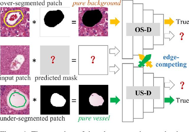 Figure 1 for Edge-competing Pathological Liver Vessel Segmentation with Limited Labels