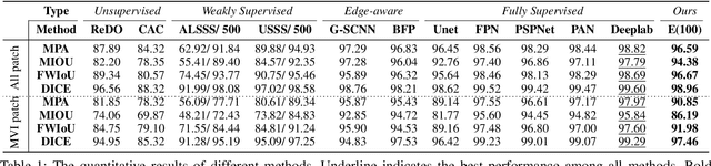 Figure 2 for Edge-competing Pathological Liver Vessel Segmentation with Limited Labels