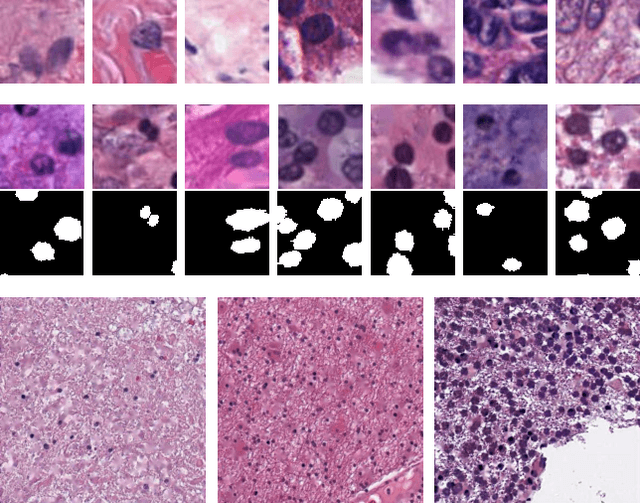Figure 1 for Unsupervised Histopathology Image Synthesis
