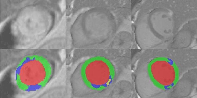 Figure 1 for Cascaded Framework for Automatic Evaluation of Myocardial Infarction from Delayed-Enhancement Cardiac MRI