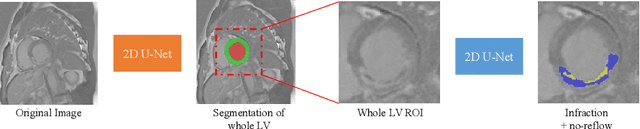 Figure 2 for Cascaded Framework for Automatic Evaluation of Myocardial Infarction from Delayed-Enhancement Cardiac MRI