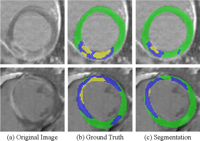 Figure 3 for Cascaded Framework for Automatic Evaluation of Myocardial Infarction from Delayed-Enhancement Cardiac MRI