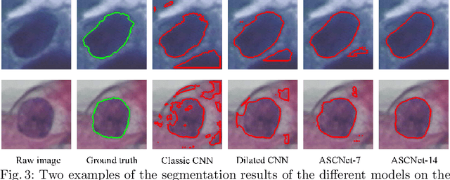 Figure 3 for ASCNet: Adaptive-Scale Convolutional Neural Networks for Multi-Scale Feature Learning