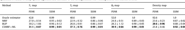 Figure 4 for Magnetic Resonance Fingerprinting with compressed sensing and distance metric learning