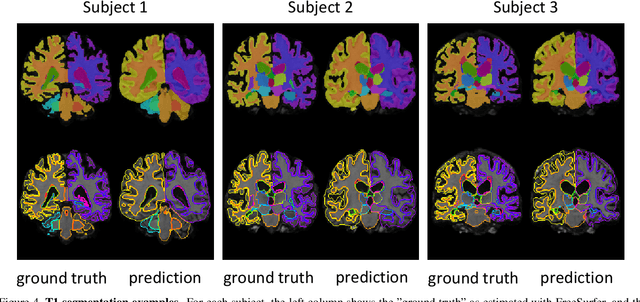 Figure 4 for Anatomical Priors in Convolutional Networks for Unsupervised Biomedical Segmentation