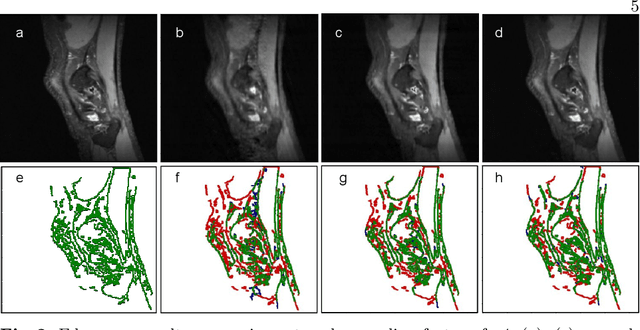 Figure 3 for Complex Fully Convolutional Neural Networks for MR Image Reconstruction