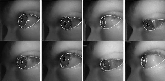 Figure 4 for Pistol: Pupil Invisible Supportive Tool to extract Pupil, Iris, Eye Opening, Eye Movements, Pupil and Iris Gaze Vector, and 2D as well as 3D Gaze