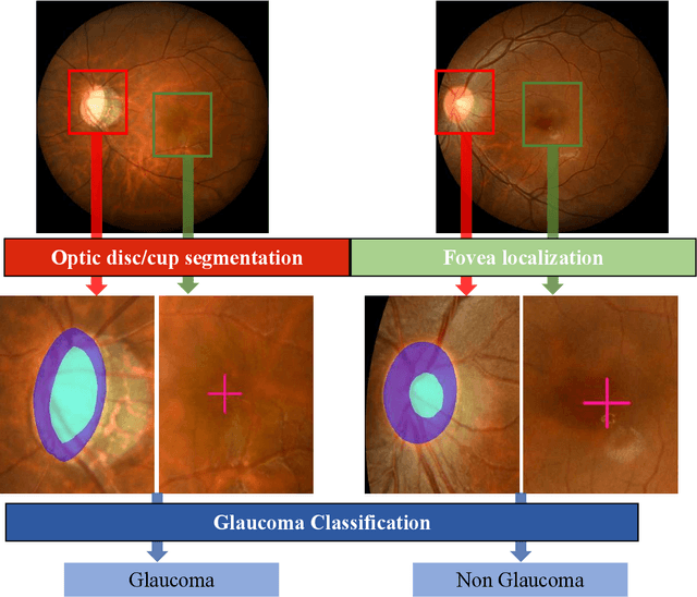 Figure 2 for REFUGE2 Challenge: Treasure for Multi-Domain Learning in Glaucoma Assessment
