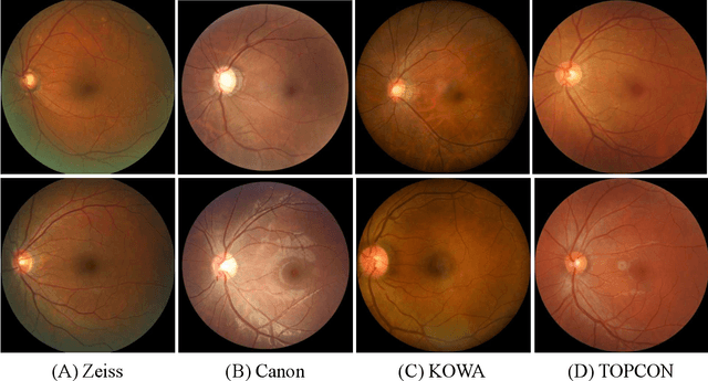 Figure 3 for REFUGE2 Challenge: Treasure for Multi-Domain Learning in Glaucoma Assessment