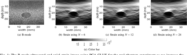 Figure 1 for Fast Strain Estimation and Frame Selection in Ultrasound Elastography using Machine Learning