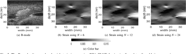 Figure 4 for Fast Strain Estimation and Frame Selection in Ultrasound Elastography using Machine Learning