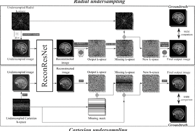 Figure 3 for ReconResNet: Regularised Residual Learning for MR Image Reconstruction of Undersampled Cartesian and Radial Data