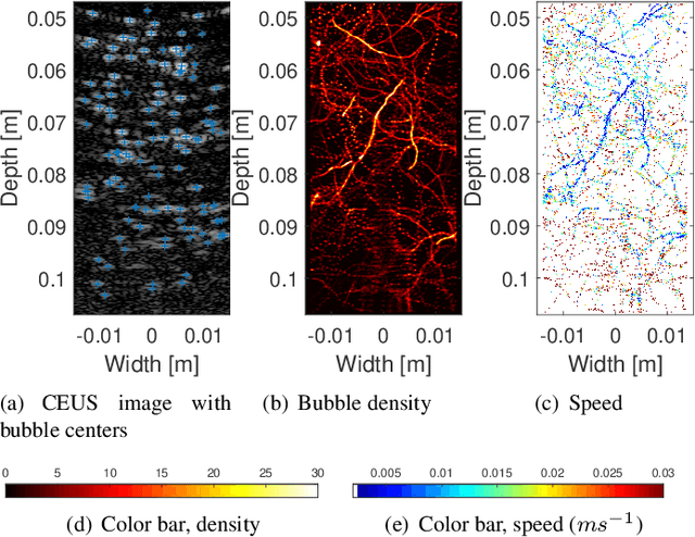 Figure 1 for Analytic Optimization-Based Microbubble Tracking in Ultrasound Super-Resolution Microscopy