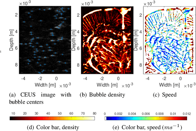 Figure 3 for Analytic Optimization-Based Microbubble Tracking in Ultrasound Super-Resolution Microscopy