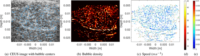 Figure 4 for Analytic Optimization-Based Microbubble Tracking in Ultrasound Super-Resolution Microscopy