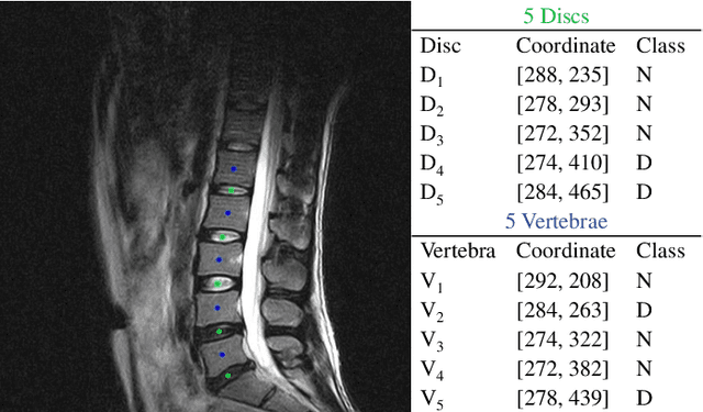 Figure 1 for SpineOne: A One-Stage Detection Framework for Degenerative Discs and Vertebrae