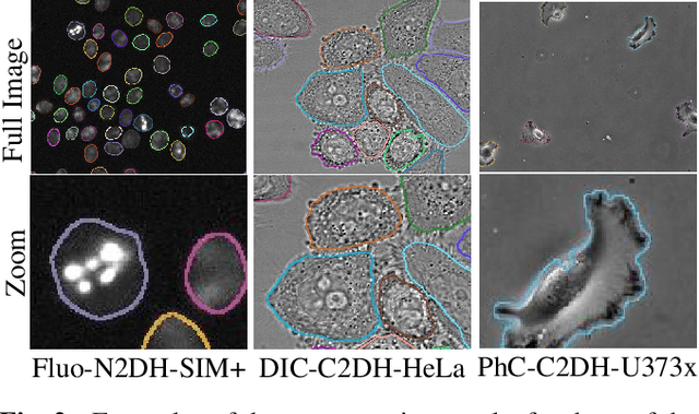 Figure 4 for Microscopy Cell Segmentation via Convolutional LSTM Networks