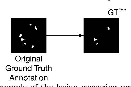 Figure 1 for Brain Metastasis Segmentation Network Trained with Robustness to Annotations with Multiple False Negatives