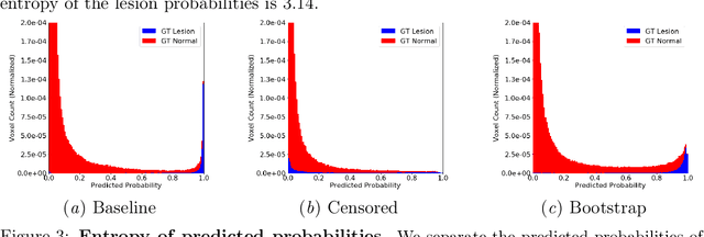 Figure 4 for Brain Metastasis Segmentation Network Trained with Robustness to Annotations with Multiple False Negatives