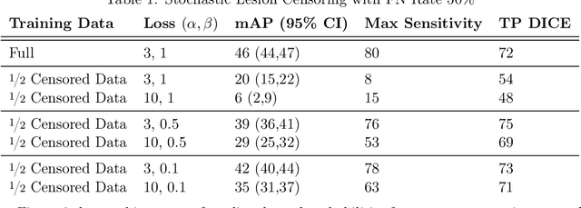 Figure 2 for Brain Metastasis Segmentation Network Trained with Robustness to Annotations with Multiple False Negatives