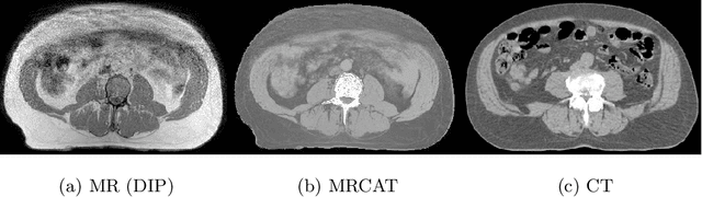 Figure 1 for Bridging the gap between paired and unpaired medical image translation