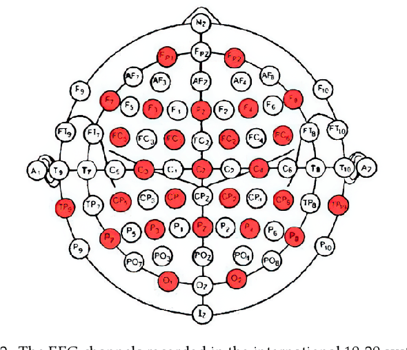 Figure 2 for Sensoring and Application of Multimodal Data for the Detection of Freezing of Gait in Parkinson's Disease