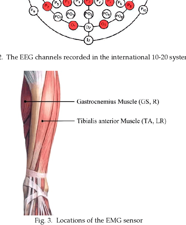 Figure 4 for Sensoring and Application of Multimodal Data for the Detection of Freezing of Gait in Parkinson's Disease