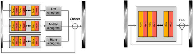 Figure 4 for Generalizable Limited-Angle CT Reconstruction via Sinogram Extrapolation