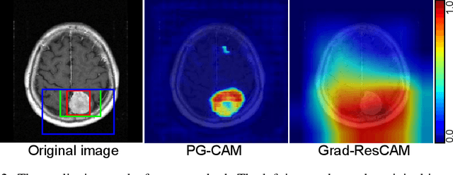 Figure 4 for Robust Tumor Localization with Pyramid Grad-CAM