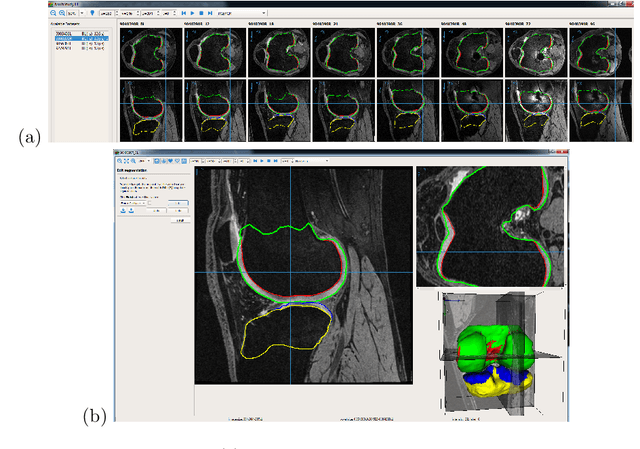 Figure 3 for Just-Enough Interaction Approach to Knee MRI Segmentation: Data from the Osteoarthritis Initiative