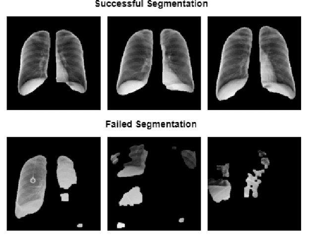 Figure 2 for RANDGAN: Randomized Generative Adversarial Network for Detection of COVID-19 in Chest X-ray