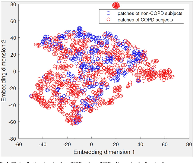 Figure 4 for Automatic Emphysema Detection using Weakly Labeled HRCT Lung Images