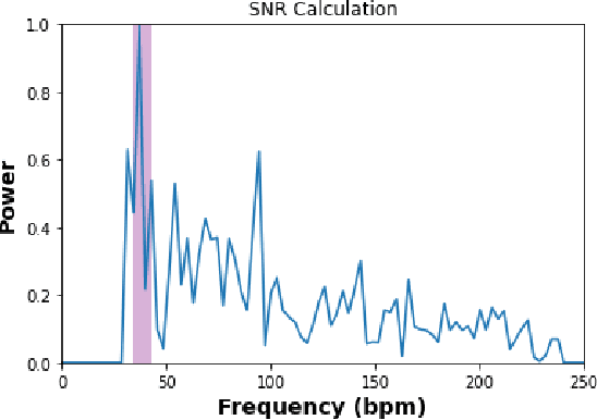 Figure 4 for ReViSe: Remote Vital Signs Measurement Using Smartphone Camera