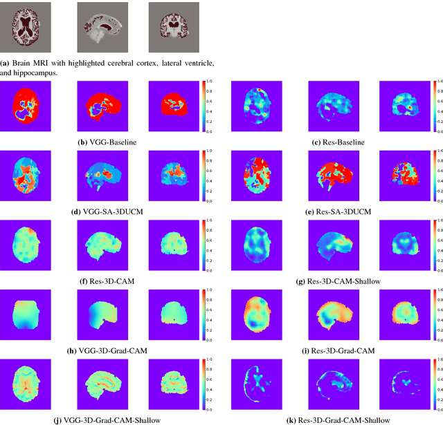 Figure 3 for Visual Explanations From Deep 3D Convolutional Neural Networks for Alzheimer's Disease Classification