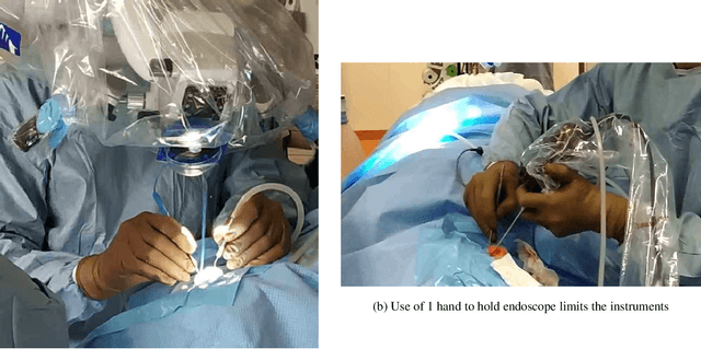 Figure 1 for Literature Review on Endoscopic Robotic Systems in Ear and Sinus Surgery