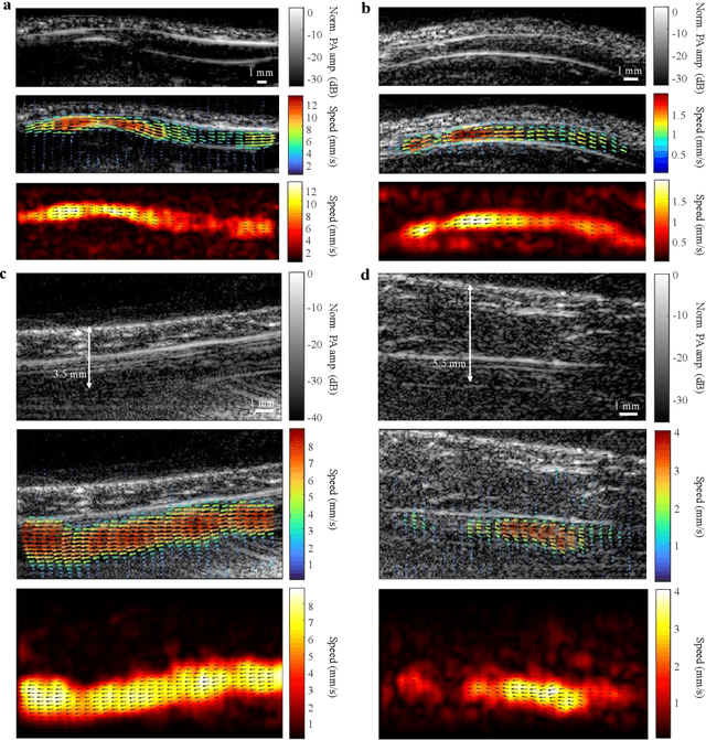 Figure 3 for Photoacoustic vector tomography for deep hemodynamic imaging