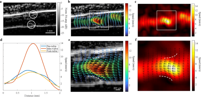 Figure 4 for Photoacoustic vector tomography for deep hemodynamic imaging