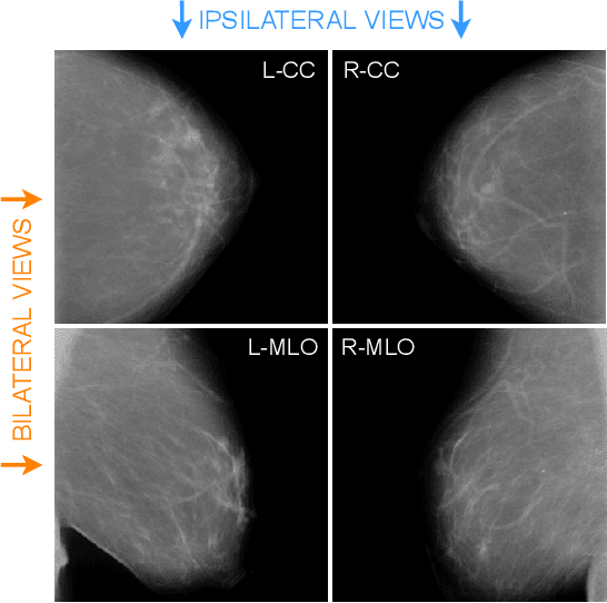 Figure 1 for Multi-View Breast Cancer Classification via Hypercomplex Neural Networks