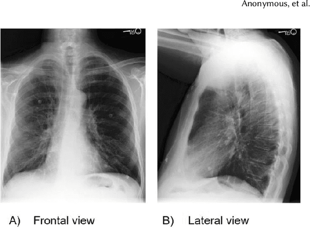 Figure 1 for CheXclusion: Fairness gaps in deep chest X-ray classifiers