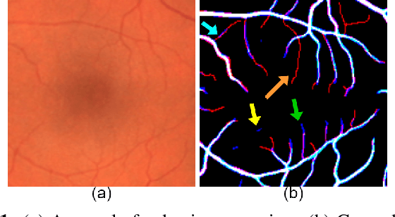 Figure 1 for Objective-Dependent Uncertainty Driven Retinal Vessel Segmentation