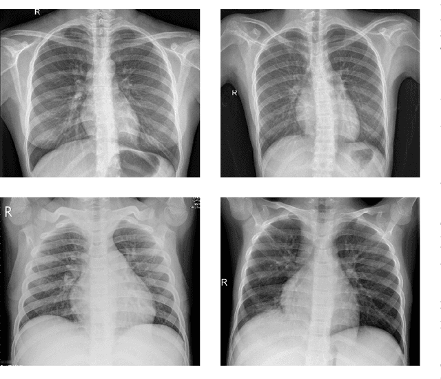Figure 2 for DEAL: Deep Evidential Active Learning for Image Classification