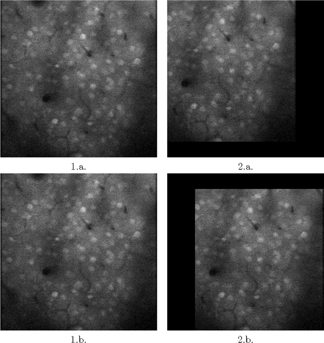 Figure 1 for moco: Fast Motion Correction for Calcium Imaging