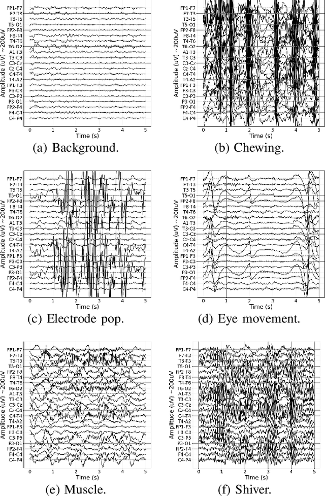 Figure 1 for Transformer Convolutional Neural Networks for Automated Artifact Detection in Scalp EEG