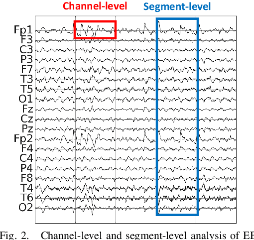 Figure 2 for Transformer Convolutional Neural Networks for Automated Artifact Detection in Scalp EEG