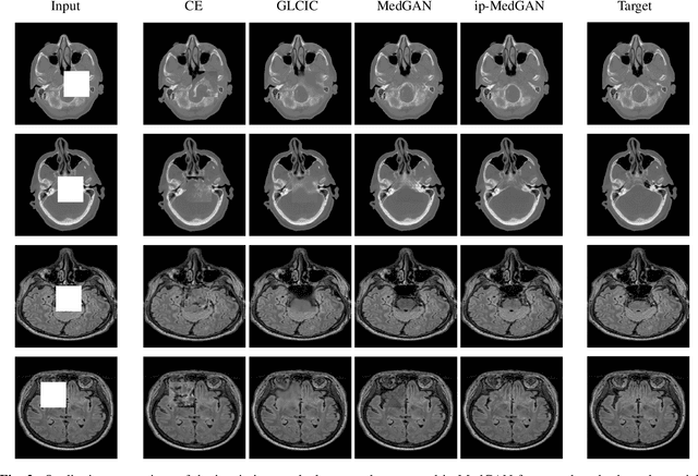 Figure 2 for Adversarial Inpainting of Medical Image Modalities