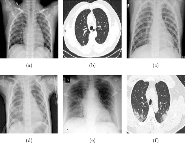Figure 3 for CVR-Net: A deep convolutional neural network for coronavirus recognition from chest radiography images