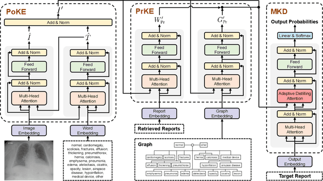 Figure 3 for Exploring and Distilling Posterior and Prior Knowledge for Radiology Report Generation