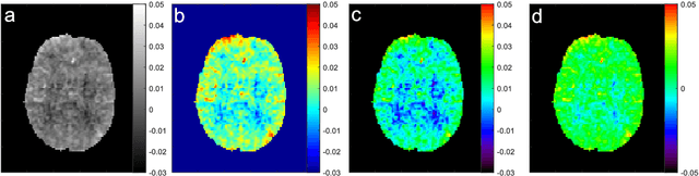 Figure 2 for snapshot CEST++ : the next snapshot CEST for fast whole-brain APTw imaging at 3T