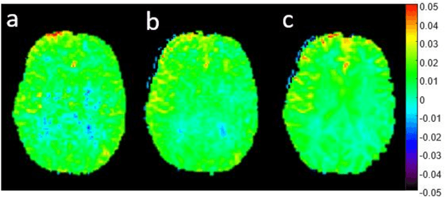 Figure 3 for snapshot CEST++ : the next snapshot CEST for fast whole-brain APTw imaging at 3T