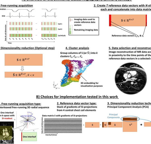 Figure 1 for Free-running SIMilarity-Based Angiography (SIMBA) for simplified anatomical MR imaging of the heart